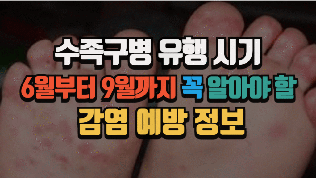 수족구병 유행 시기, 6월부터 9월까지 꼭 알아야 할 감염 예방 정보 (2025 최신)