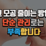 코 모공 줄이는 방법, 단순 관리로는 부족합니다 (2025 최신) 5 코 모공 줄이는 방법, 단순 관리로는 부족합니다 (2025 최신)