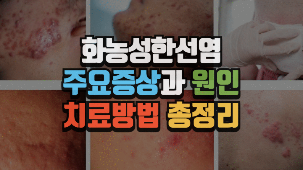 화농성한선염, 주요 증상과 원인 그리고 치료 방법까지